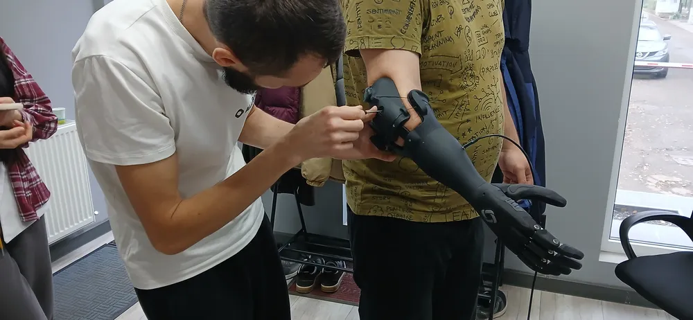 Біонічні протези